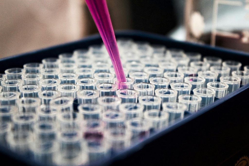 Plasma donation can be lucrative for extra money while helping other people with medical conditions